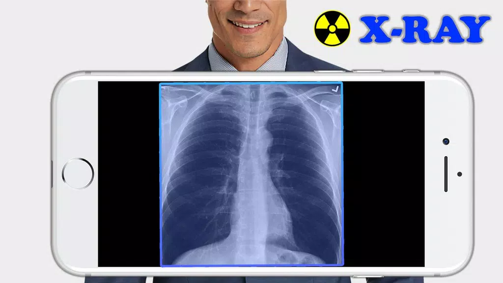 X-Ray Filter Photo Tangkapan skrin 0