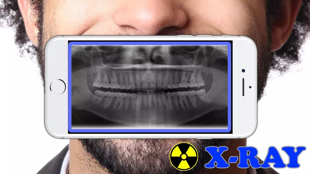 X-Ray Filter Photo Tangkapan skrin 1