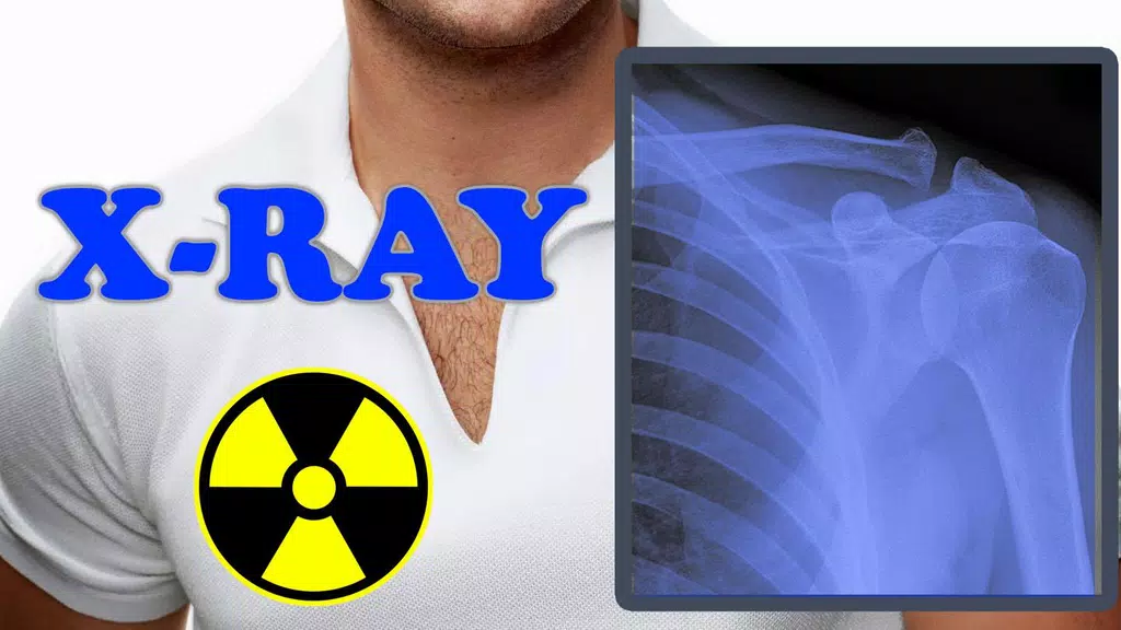 X-Ray Filter Photo Tangkapan skrin 2